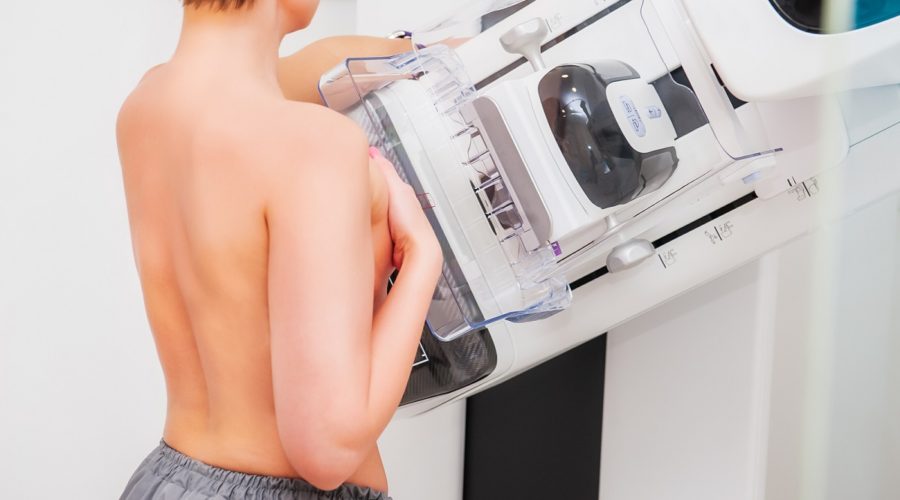 mammografia 3d con tomosintesi su veicolo medicale