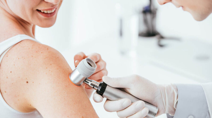 maggio mese prevenzione melanoma
