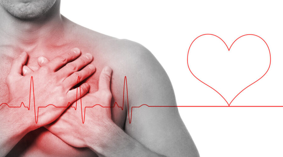 malattie cardiovascolari